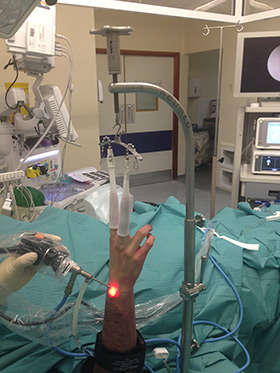 Arthroscopic Wrist Surgery